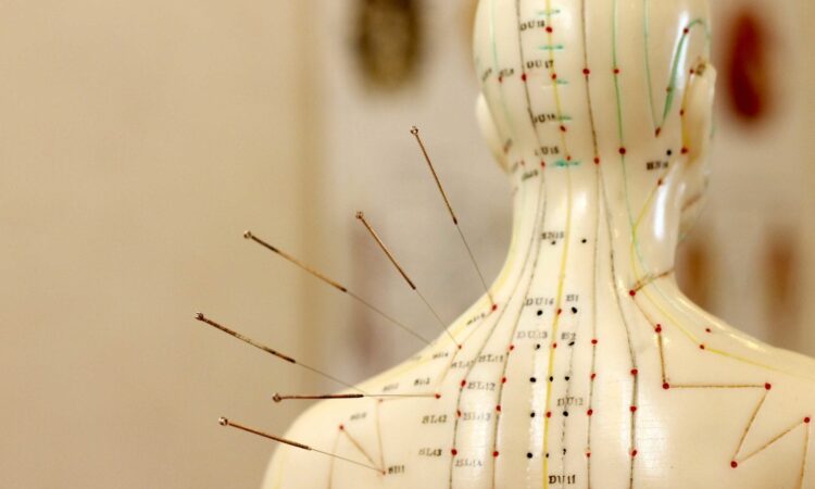 Agopuntura, tra eco-doppler e risonanze così la scienza misura l’antica medicina